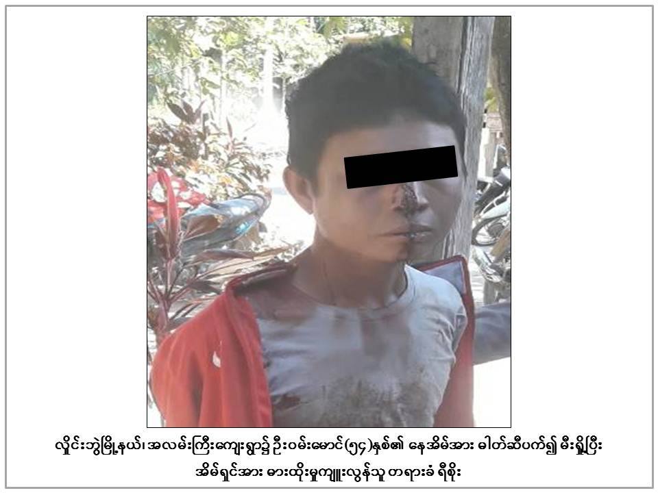ေနအိမ္ဓာတ္ဆီေလာင္း မီး႐ႈိ႕သူက အိမ္ရွင္ကုိ ဓားျဖင့္ထုိးသတ္