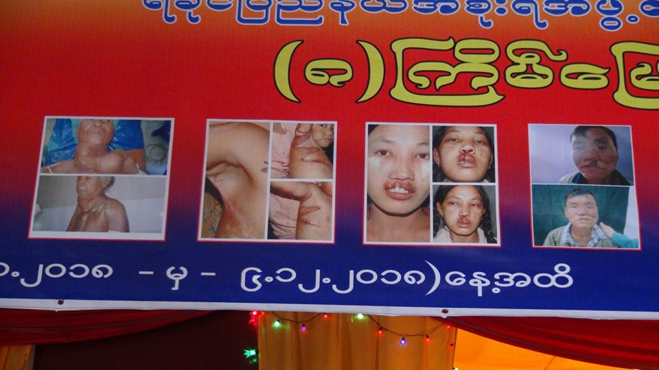 စစ္ေတြတြင္ ႏႈတ္ခမ္းကြဲ၊ အာေခါင္ကြဲေရာဂါ အခမဲ့ကုသေပးေန