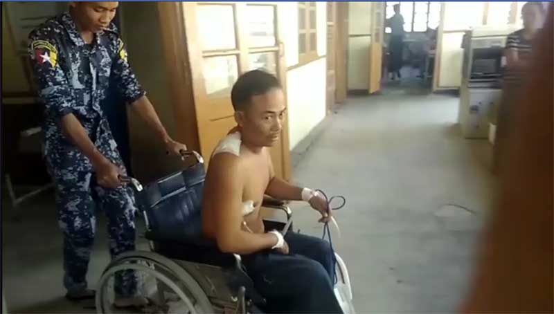 ကိုယ့္တိုင္းရင္းသားအခ်င္းအခ်င္း ဒီလိုမလုပ္သင့္ဘူး - ခထီးလွရဲကင္းစခန္း ဒဏ္ရာရ ရဲတပ္သား