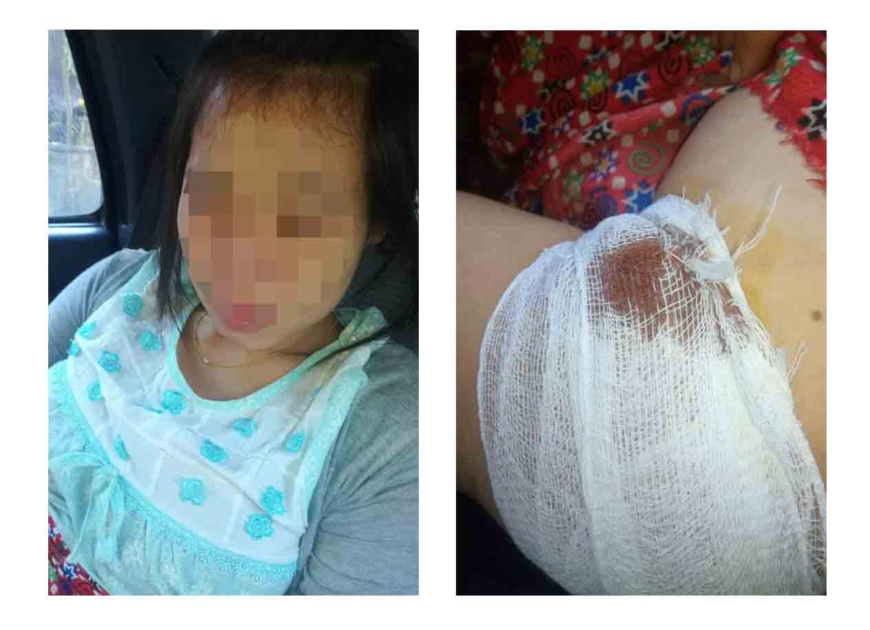 ေျမာက္ဦးတြင္ ပစ္ခတ္မႈေၾကာင့္ ကိုယ္ဝန္ေဆာင္အမ်ိဳးသမီးငယ္တဦး ဒဏ္ရာရ