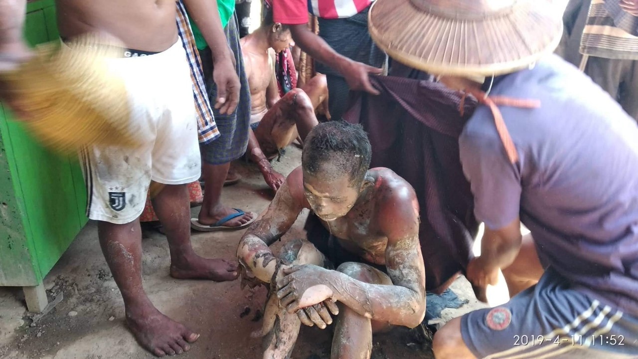 ကသာၿမိဳ႕တြင္ ဆီေဘာက္ဆာကား ဆီျဖည့္စဥ္ မီးေလာင္၊ လူ ၄ ဦး ဒဏ္ရာရ