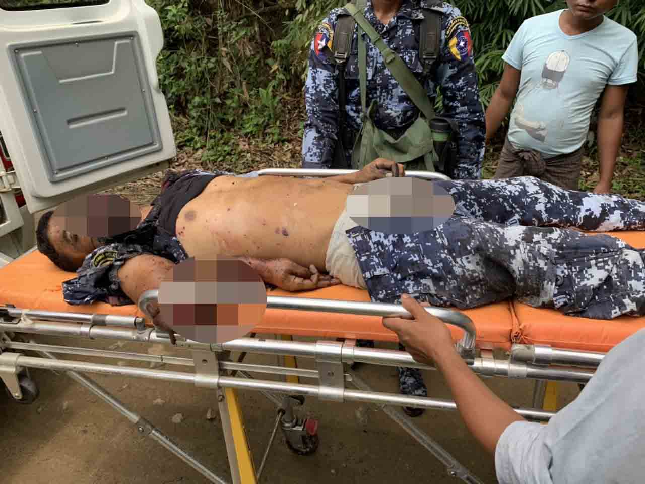 ေမာင္​​ေတာတြင္ ဗံုးသီးမေတာ္တဆေပါက္ကြဲၿပီး နယ္ျခားေစာင့္ ရဲ ၁ ဦး ေသဆံုး၊ ၃ ဦးဒဏ္ရာရ