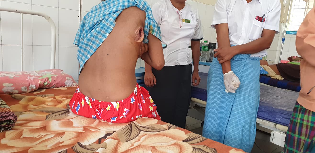 စတိုးဆိုင္ဝန္ထမ္း မိန္းကေလး ၁ ဦး ညႇဥ္းပန္းႏွိပ္စက္ခံရၿပီး မံုရြာေဆး႐ံုတြင္ ေဆးကုသမႈခံယူေနရ