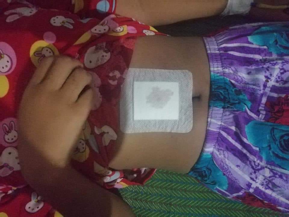 ဝမ်းဗိုက်ကျည်ထိမှန်သည့် ရှစ်တန်းကျောင်းသူအား စစ်တွေဆေးရုံသို့ အရေးပေါ်ပို့ဆောင်