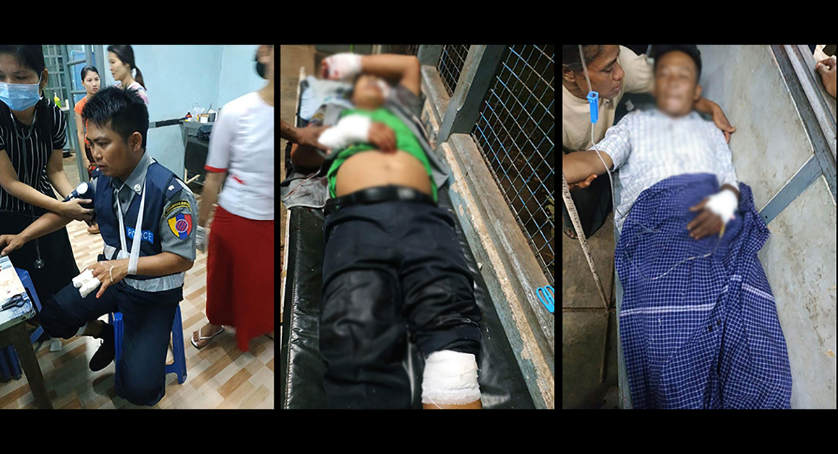 တန်ဆောင်မုန်းလပြည့်ညက ကျုံဒိုးမြို့တွင် ဗုံးခွဲတိုက်ခိုက်ခံရ ရဲ ၂ ဦး၊ အရပ်သား ၂ ဦး သေဆုံး