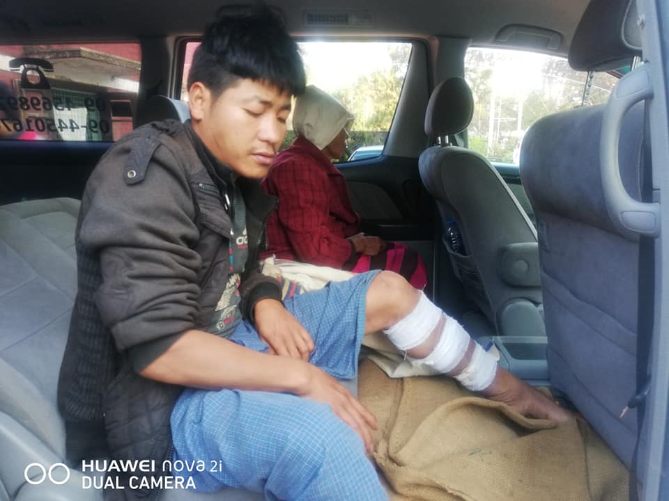 ကျောက်မဲတွင် ရွာသား ၂ ဦး မိုင်းထိ ဒဏ်ရာရ
