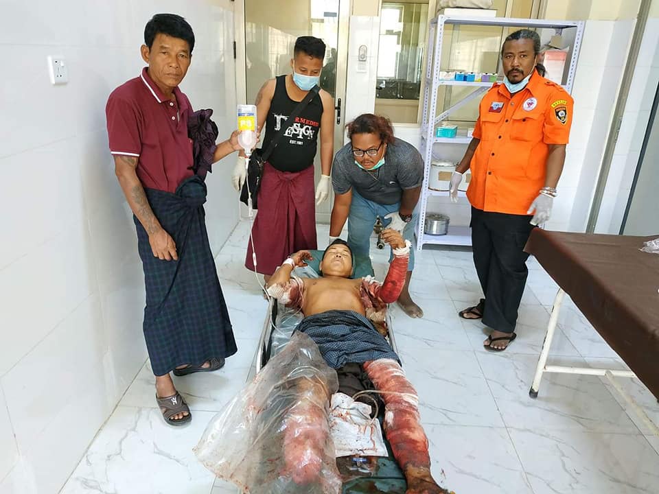 ရသေ့တောင်မြို့နယ်တွင် မိုင်းနင်းမိ၍ အရပ်သား ၃ ဦးဒဏ်ရာရ