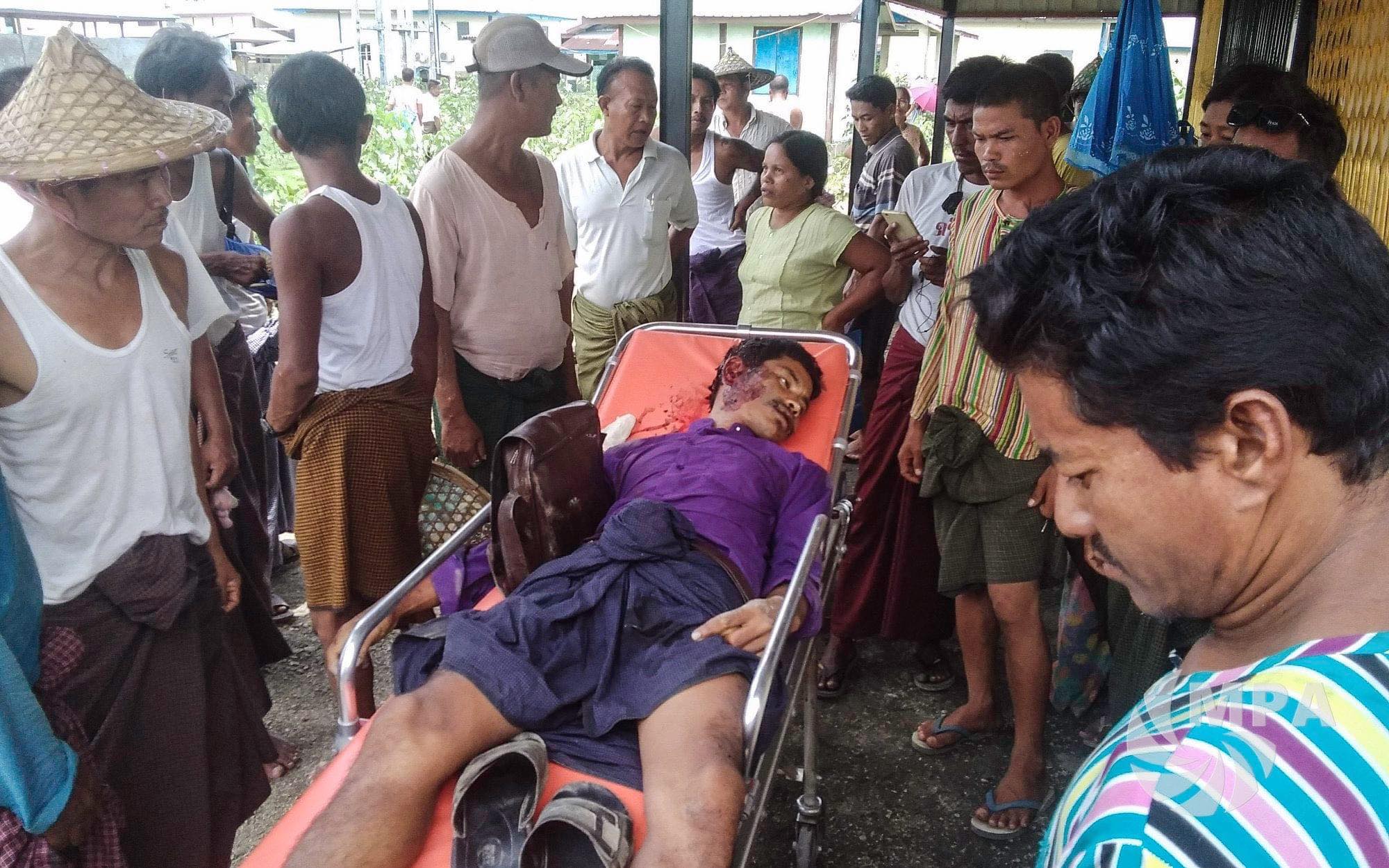 ပုဏ္ဏားကျွန်းမြို့အဝင်တွင် ဆွဲမိုင်း ပေါက်ကွဲပြီး  အရပ်သား  ၁ ဦးသေဆုံး၊ ၁ ဦးဒဏ်ရာရ