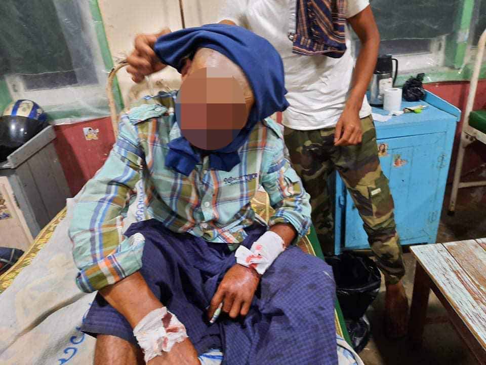 ဖားကန့်တွင် ဝက်ဝံကုတ်ခံရသည့် အမျိုးသား ၁ ဦး ဆေးရုံတင်ထားရ 