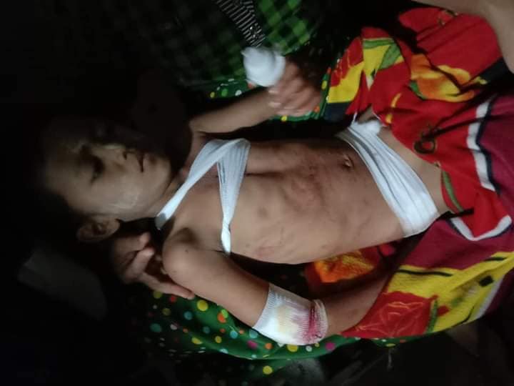 အမ်းမြို့နယ်၌ လက်နက်ကြီးကျည်ကျပြီး ကလေးငယ် ၃ ဦးအပါအဝင် ၆ ဦး ဒဏ်ရာရ