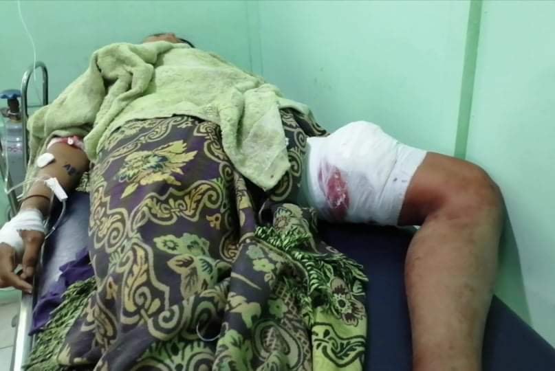ကလေးမြို့၌ သပိတ်စစ်ကြောင်းကို စစ်တပ်နှင့်ရဲက ပစ်ခတ်ဖြိုခွင်း၊ အမျိုးသား ၅ ဦး ကျည်ထိမှန် ၃ ဦး အပြင်းထန်ဒဏ်ရာရ