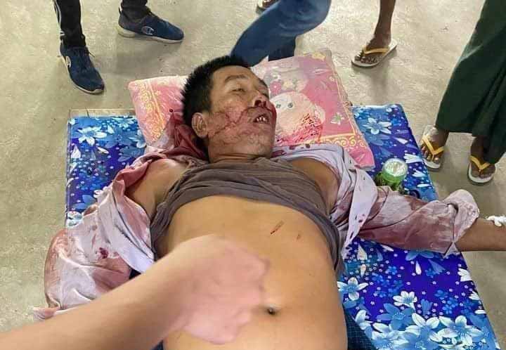 ကောလင်းမြို့တွင် သပိတ်စစ်ကြောင်း ဖြိုခွင်းခံရသဖြင့် အမျိုးသား ၁ ဦး ကျဆုံး