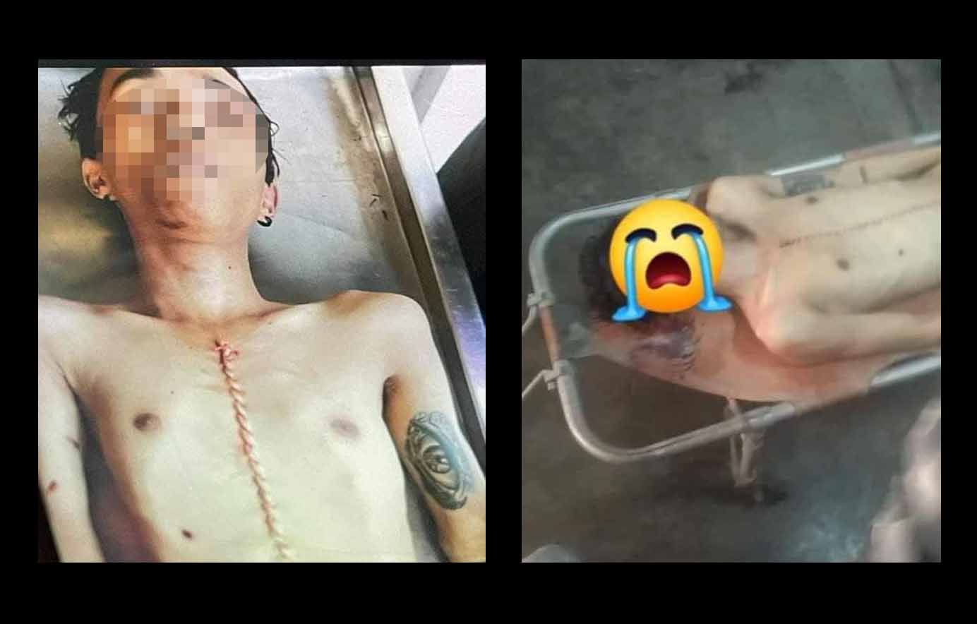 ယုဇနဥယျာဉ်မြို့တော်တွင် လူငယ် ၂ ဦး ထပ်မံကျဆုံး