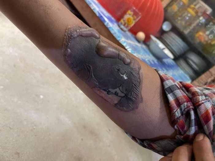 လူငယ် ၁ ဦးကို စစ်တပ်ကဖမ်းဆီးပြီး လက်ပေါ်ထိုးထားသည့် ဒေါ်အောင်ဆန်းစုကြည်ပုံ တက်တူးကို မီးအပူဖြင့်ကပ်ဖျက်ဆီး
