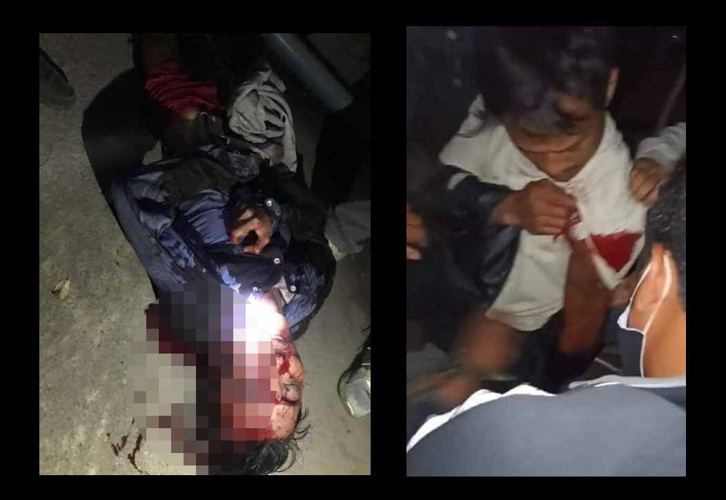 ညောင်ရွှေတွင် စစ်တပ်နှင့်ရဲကအကြမ်းဖက်ပစ်ခတ်သဖြင့် လူငယ် ၁ ဦးသေဆုံး ၁၀ ကျော်ဒဏ်ရာရ
