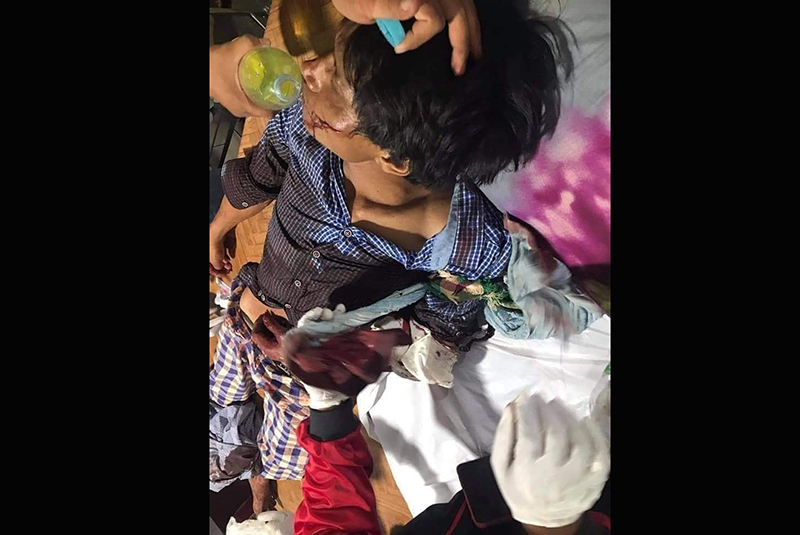 မြင်းခြံမြို့တွင် စစ်တပ်က ပစ်ခတ်သဖြင့် ပြည်သူ ၁ ဦးကျည်ဆန်ထိမှန်ဒဏ်ရာရ
