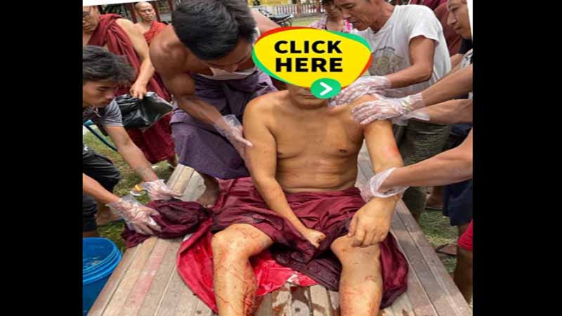 မိုးမောက်မြို့နယ်တွင် တိုက်ပွဲဖြစ်၊ သံဃာ ၁ ပါး ပျံလွန်ပြီး ပြည်သူ ၂  ဦးသေဆုံး