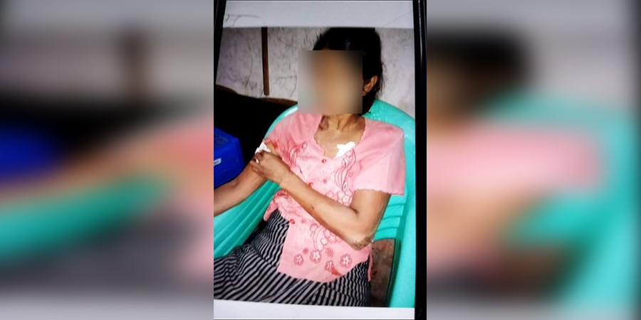 ညောင်တုန်းမြို့၌ ဆက်တိုက် ဗုံးကွဲ အမျိုးသမီး ၁ ဦးဒဏ်ရာရ