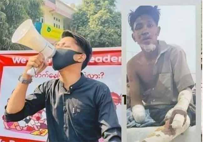 စစ်တပ်လက်ချက်ကြောင့်လက်တစ်ဖက်ပြတ်ခဲ့ရသည့် ကိုလျှံဖြိုးအောင်ကို မကွေးထောင်သို့ ပို့ဆောင်