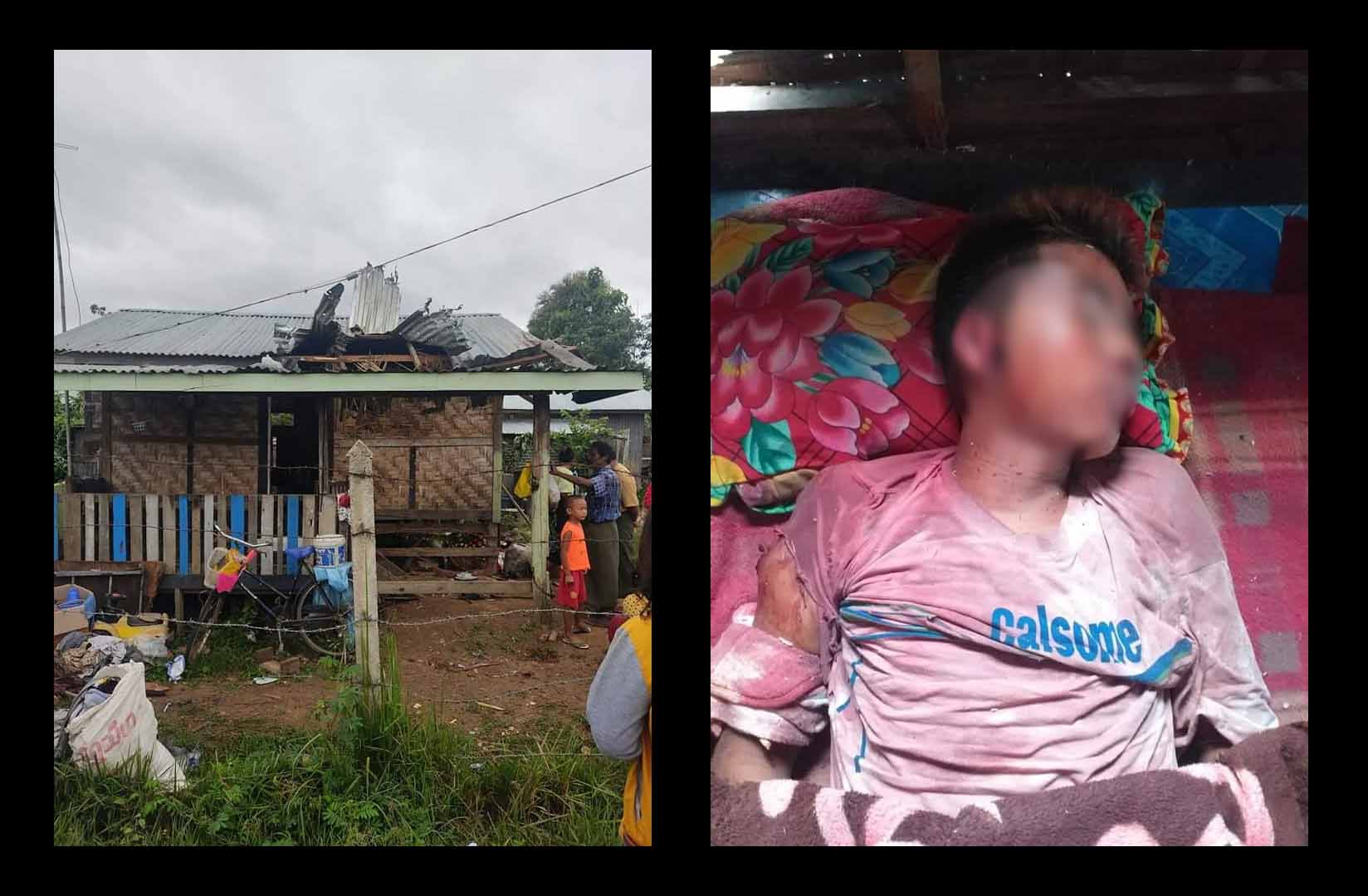 လွိုင်ကော်တွင် အကြမ်းဖက်စစ်တပ်က လက်နက်ကြီးဖြင့်ပစ်ခတ်၊ လူငယ် ၁ ဦး သေဆုံး