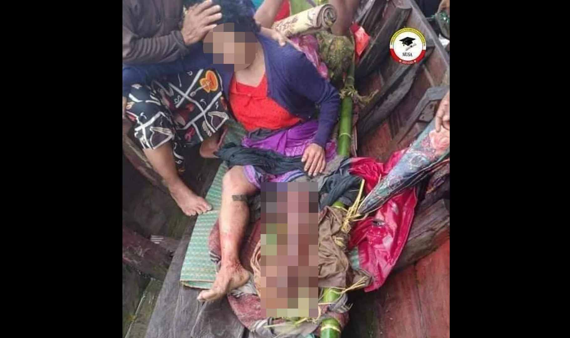 ကျောက်တော်မြို့နယ်၌ မြေမြှုပ်မိုင်းကွဲပြီး အမျိုးသမီး ၁ ဦး ပြင်းထန်ဒဏ်ရာရ