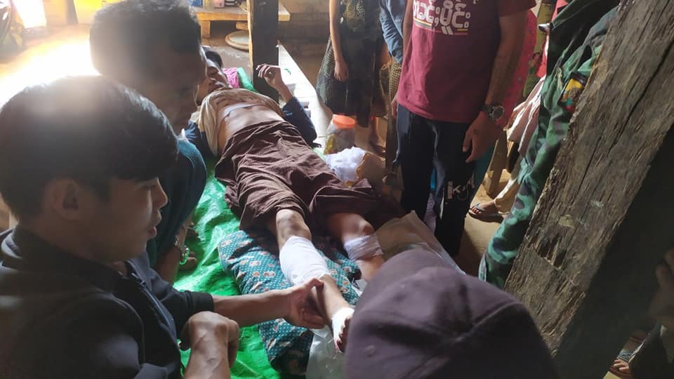 တိုက်ပွဲကြောင့် ကျောက်မဲမြို့နယ် ပန်လင်ရွာ စစ်ရှောင်များ အရေးပေါ်အကူအညီ လိုအပ်နေ
