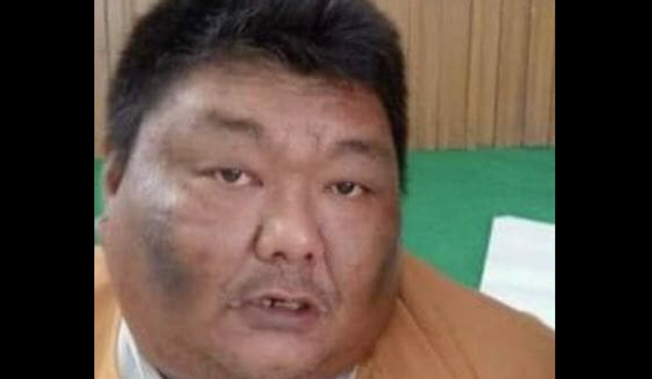 မန္တလေးတွင် အန်အယ်လ်ဒီပါတီဝင် ၁ ဦး ဖမ်းဆီးနှိပ်စက်ခံရပြီး သေဆုံး၊ အလောင်းပြန်မရ