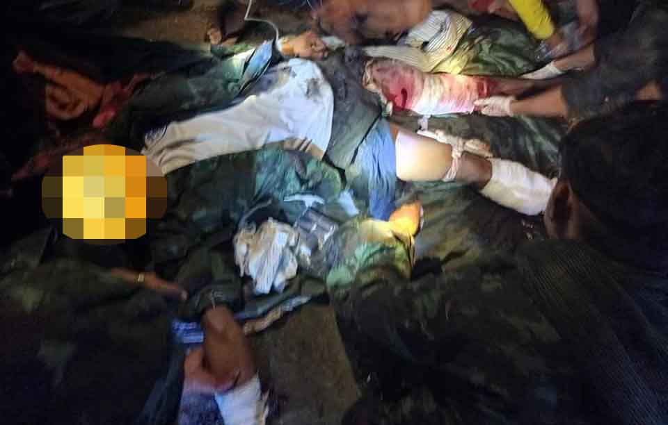 ဒီးမော့ဆိုတွင် ပျောက်ဆုံး ဝမ်းကွဲညီအစ်ကိုနှစ်ဦး သေဆုံးလျက်ပြန်တွေ့