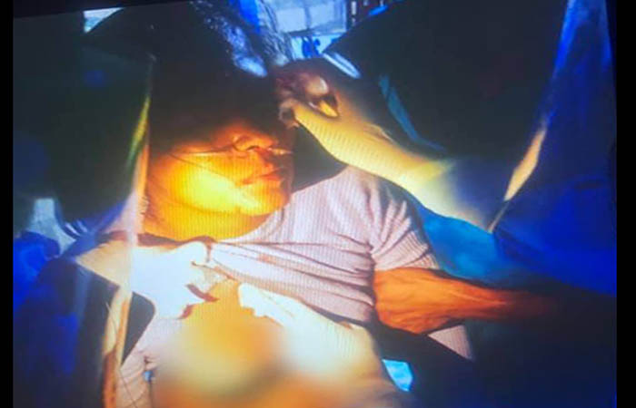 ကြူကုတ် (ပန်ဆိုင်း) မှာ ပြည်သူ ၁ ဦး လက်နက်ကြီးကျည်စ ထိမှန် ဒဏ်ရာရ