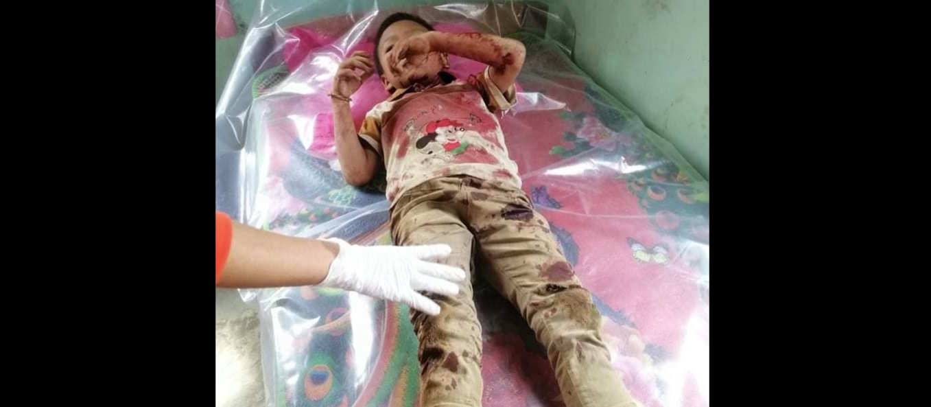 မိုးဗြဲတွင် စစ်တပ်ကလက်နက်ကြီးဖြင့်ပစ်ခတ်သဖြင့် အမျိုးသမီး ၁ ဦးသေ၊ ကလေးများအပါအဝင် ၆ ဦး ဒဏ်ရာရ