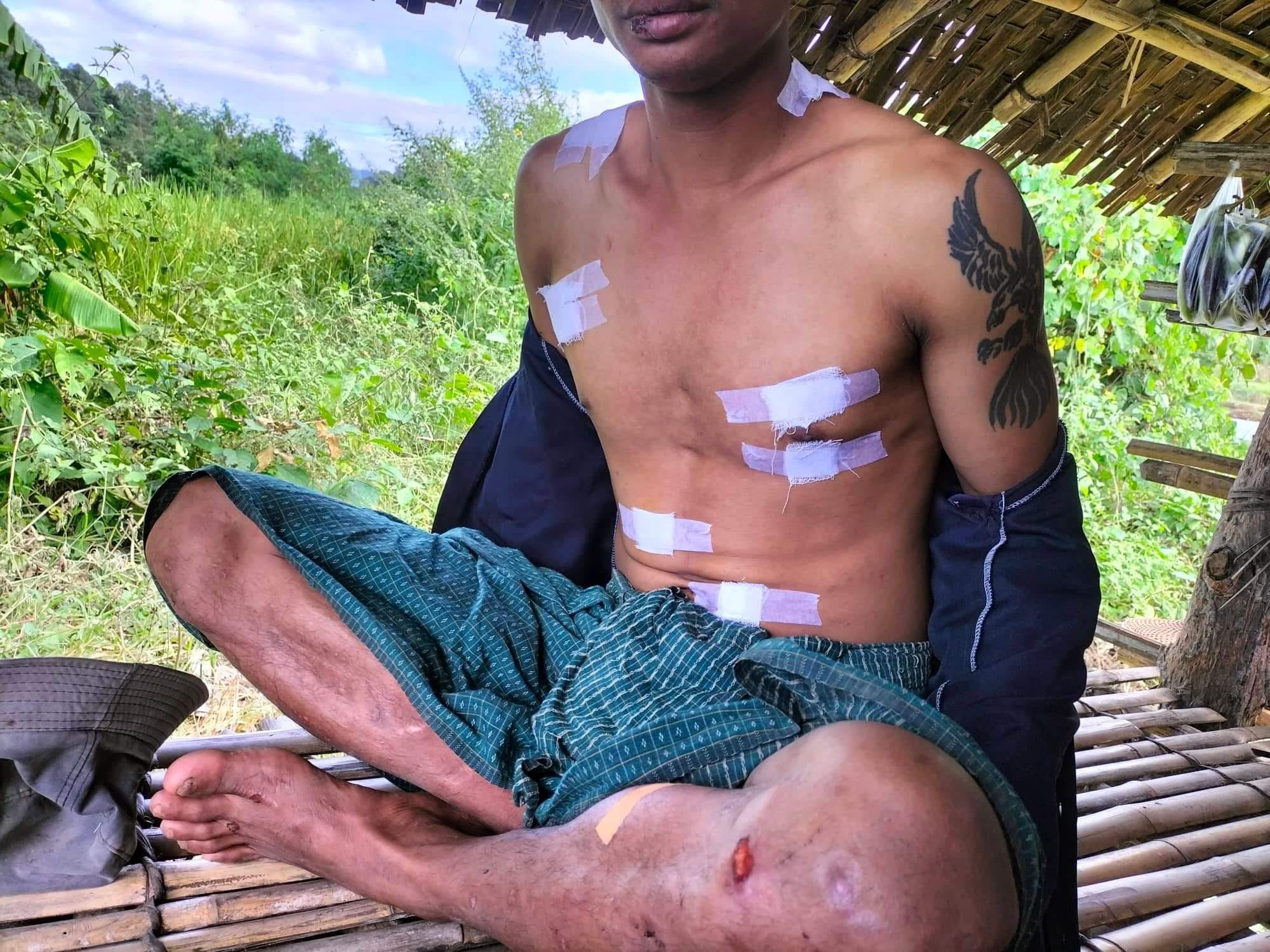 ဖမ်းဆီးနှိပ်စက်ခံရသည့် ပြည်သူတစ်ဦး သေနတ်လု ထွက်ပြေးလွတ်မြောက်၊ ဆော PD‌F က ဘေးကင်းရာပို့