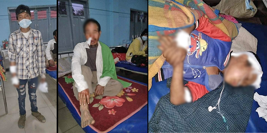 မိုင်းကိုင်တွင် ခွေးတကောင်မိုင်းနင်းမိရာက မြေးအဘိုး ၃ ဦး မိုင်းစထိမှန်ဒဏ်ရာရ