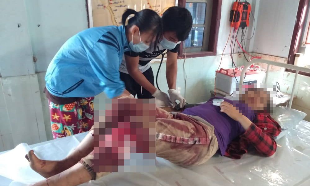 ကော့ကရိတ် မြို့ဟောင်းရွာကို စစ်ကောင်စီတပ်က လက်နက်ကြီးဖြင့်ပစ်ခတ် ဒေသခံ ၈ ဦး ထိမှန်