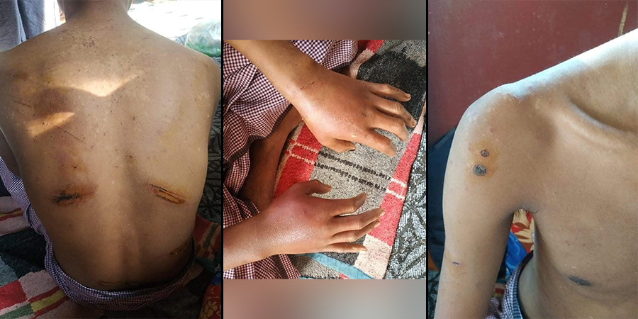 လက်ယက်မရွာသား ၃ ဦးအား စစ်ကောင်စီက သတ်ဖြတ်ပြီး လူ ၇၀ ခန့်ကို ဖမ်းဆီးနှိပ်စက်