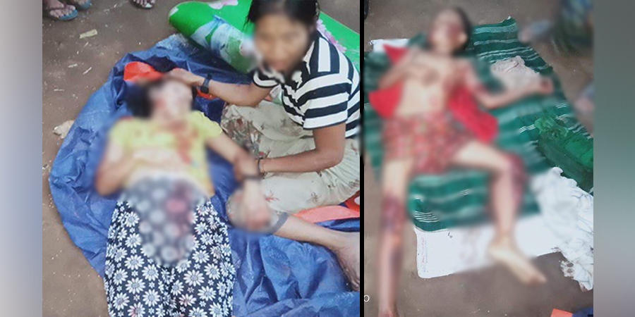 ပုလောမြို့နယ်တွင် မိုင်းနင်းမိသဖြင့် ကိုယ်ဝန်ဆောင်မိခင်နှင့်သားဖြစ်သူ သေဆုံး