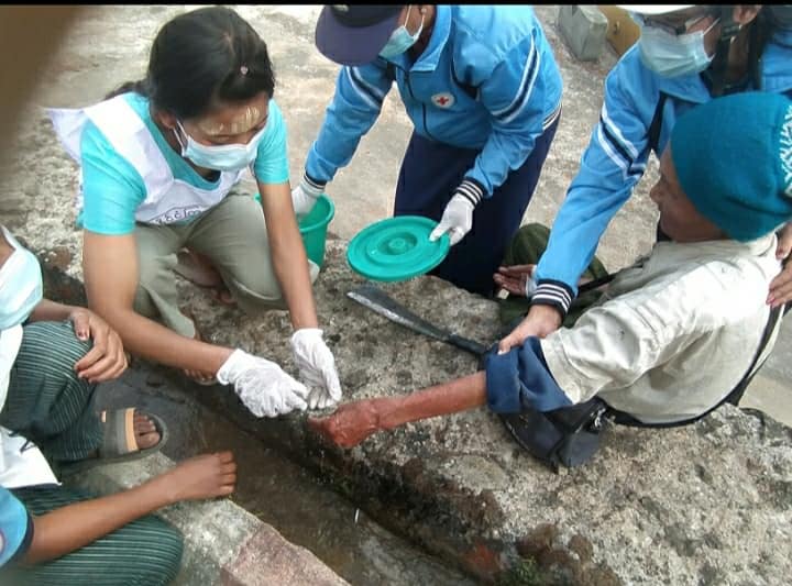 မိုးကုတ်မြို့တွင် ဓာတ်ဆီဆိုင်မီးလောင်၊ ဆိုင်ပိုင်ရှင် ဒဏ်ရာရ
