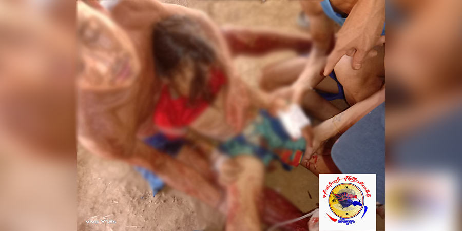 ဖာပွန်မြို့နယ်၌ စစ်တပ်က လက်နက်ကြီးပစ်ခတ်သဖြင့် ကလေးငယ်အပါအဝင် ၄ ဦး ဒဏ်ရာရ