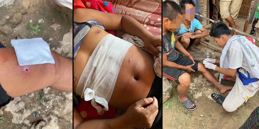 သီပေါတွင် ထင်းခွေသွားသည့်ရွာသား ၂ ဦးမိုင်းထိ၊ ၁ ဦးဒဏ်ရာပြင်းထန်