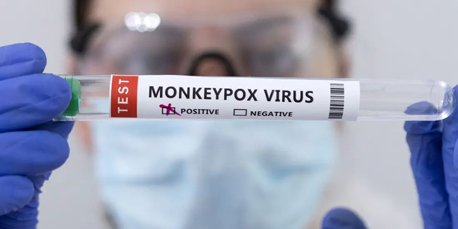 “Monkeypox မျောက်ကျောက်ရောဂါ ဘာလဲ၊ ဘယ်လို ကူးစက်တတ်သလဲ” ဒေါက်တာသိန်းဝင်းနှင့် မေးမြန်းချက်