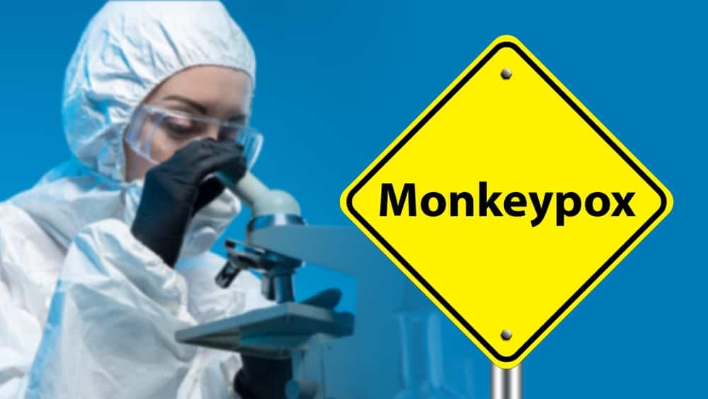 Monkeypox ရောဂါက စိုးရိမ်စရာ ဖြစ်လာနိုင်သလား