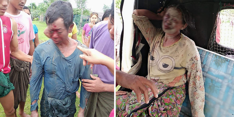 ရသေ့တောင်တွင် မိုင်းပေါက်ကွဲမှုကြောင့် လယ်သမားလင်မယား ၂ ဦး ဒဏ်ရာရ