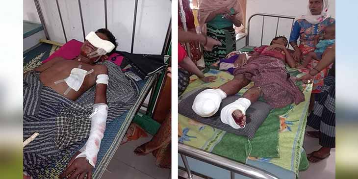 မြောက်ဦးတွင် စစ်ကောင်စီတပ်အနီး နွားကျောင်းသည့် ကလေး ၄ ဦး မြေမြှုပ်မိုင်းထိမှန် ဒဏ်ရာရ