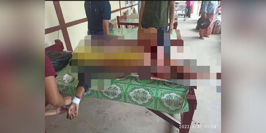 ကသာမြို့တွင် မိုင်းပေါက်ကွဲပြီး ပုလင်းခွံကောက်သည့်သားအမိ ၂ ဦး ထိမှန်၊ သမီးဖြစ်သူ သေဆုံး