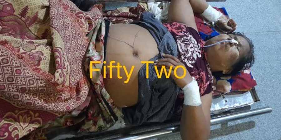 ကလေးဝမြို့နယ် ရဲကင်းစခန်း စီးနင်းခံရပြီး ရဲ ၇ ဦး သေဆုံး၊ ကလေးမြို့နယ်က ပျူစောထီး အဖွဲ့ဝင်နှင့်ဇနီး ပစ်သတ်ခံရ