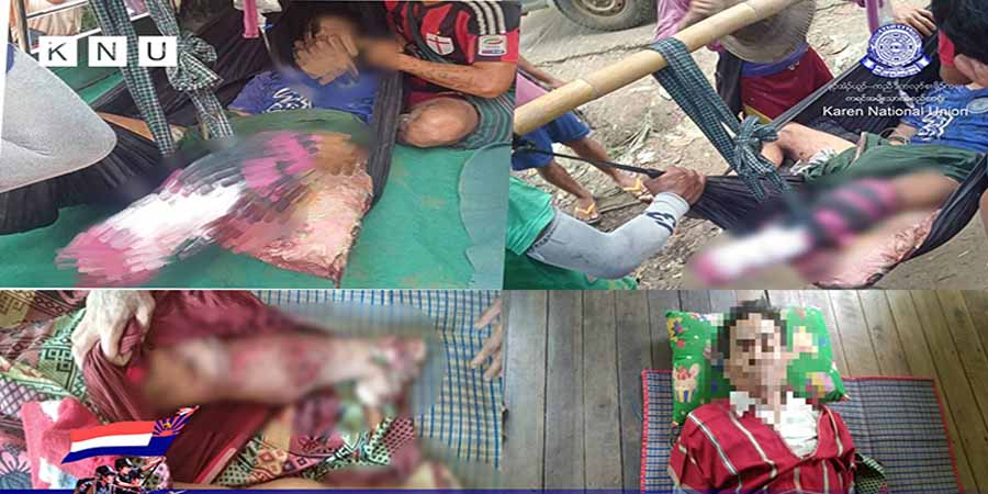 မုန်းမြို့နယ်တွင် စစ်ကောင်စီထောင်ထားသည့် မိုင်းနင်းမိပြီး ပြည်သူ ၁ ဦး သေဆုံး