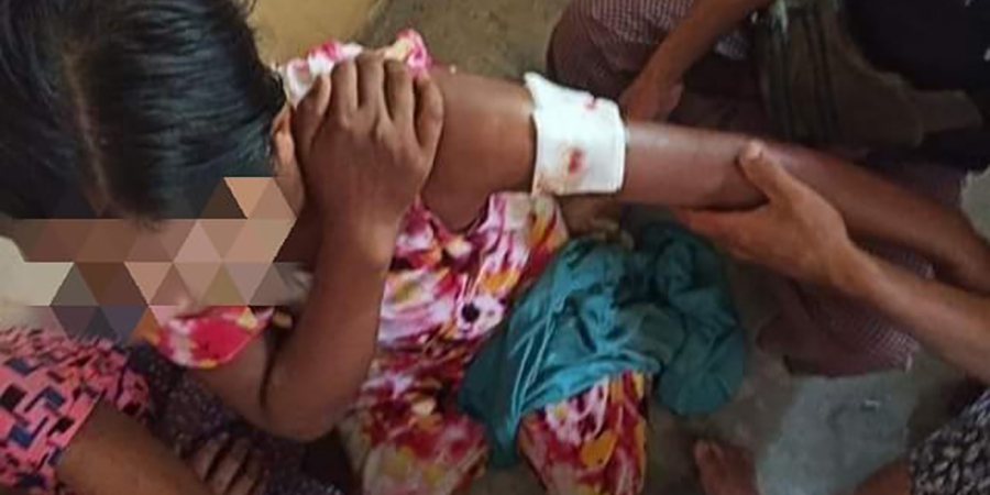 မင်းပြားမြို့နယ်၌ စစ်ရေယာဥ်တိုက်ခိုက်ခံရပြီးနောက် လေကြောင်းတိုက်ခိုက်မှုကြောင့် ပြည်သူ ၂ ဦး သေဆုံး
