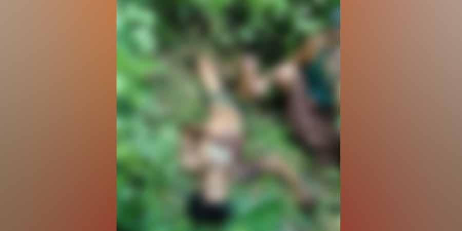 မြောက်ဦး၌ လူငယ် ၁ ဦး မိုင်းထိသဖြင့် ခြေနှစ်ဖက်ပြတ်