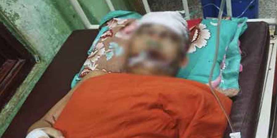 ပခုက္ကူမြို့နယ်၌ သံဃာတော်များလိုက်ပါလာသည့်ကား မိုင်းထိမှန်ပြီး ၁ ပါး ပျံလွန်တော်မူ
