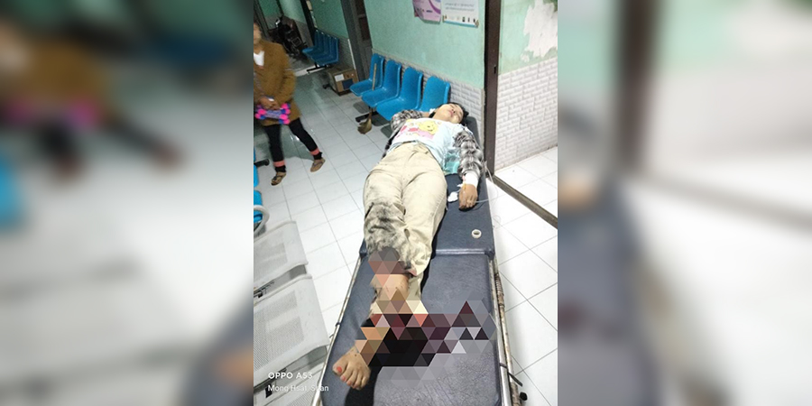 ရှမ်းပြည်အရှေ့ပိုင်း မိုင်းပြင်းဈေးတွင် မိုင်းပေါက်ကွဲ၊ အမျိုးသမီး ၁ ဦးဒဏ်ရာရ