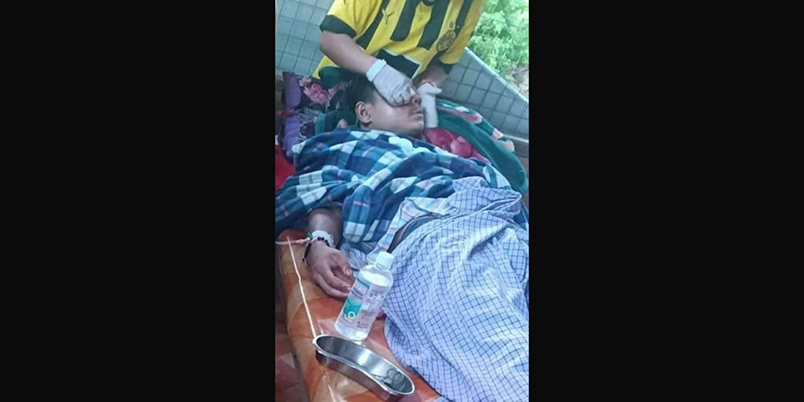 ဖယ်ခုံ PDF တပ်ရင်း ၂ အတွက် အရေးပေါ်ဆေးဝါးနှင့် လက်နက်ကျည် အကူအညီလိုအပ်နေ